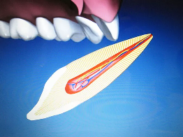 Ausgeschlagener Zahn durch Unfall – zahnmedizinische Notfallversorgung in der ACC Zahnklinik Basel