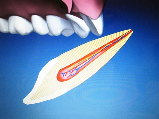 Ausgeschlagener Zahn durch Unfall – zahnmedizinische Notfallversorgung in der ACC Zahnklinik Basel