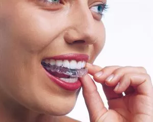 Invisalign und Aligner-Therapie – moderne, transparente Zahnkorrektur ohne feste Spangen in der ACC Zahnklinik Basel