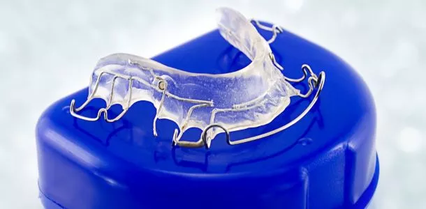 Klassische Drahtspange als Grundversorgung in der Kieferorthopädie – Zahnspangenarten in der ACC Zahnklinik Basel