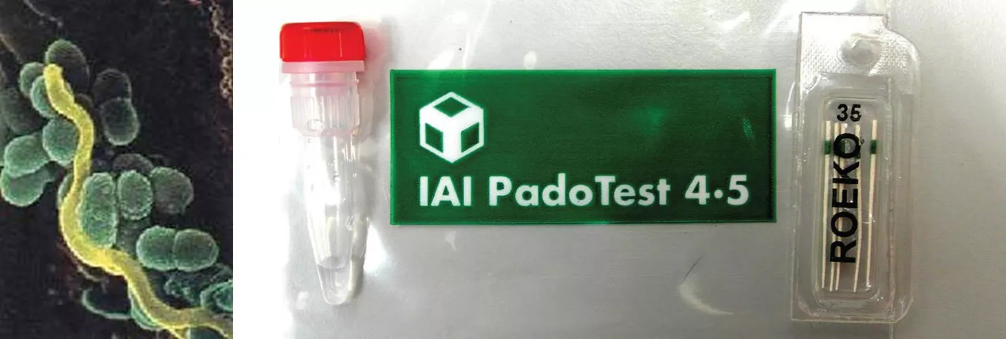 IAI PadoTest® zur mikrobiologischen Zusatzdiagnostik bei Parodontitis – gezielte Keimbestimmung in der ACC Zahnklinik Basel